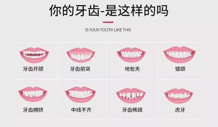 牙歪嘴突下巴短,脸型不佳竟是牙齿畸形惹的祸!